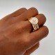 Zirconia Ring 1 Zirconia Ring 1